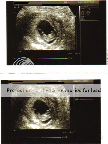 ultrasound10weeks.jpg