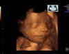 30 week sono.jpg