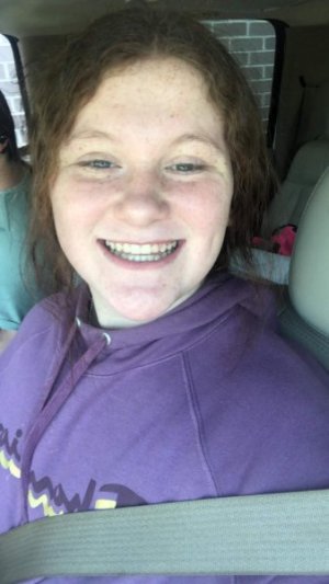 Lily braces off July 13  2022.jpeg