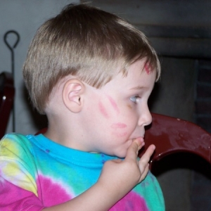 kiss