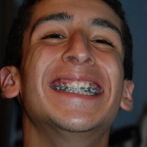 orthodonture