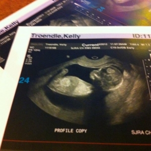 ultrasound