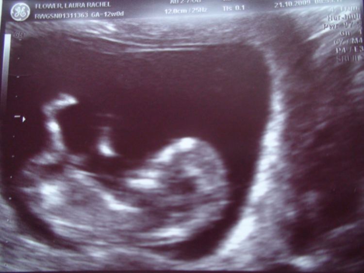 Baby Bump