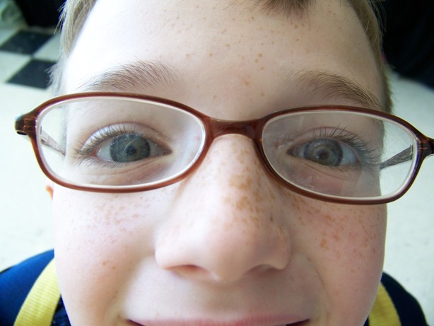 CLOSE UP