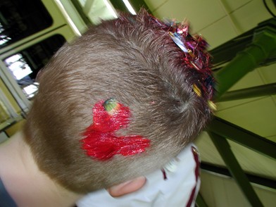 Harmony Barbers -Mickey Head