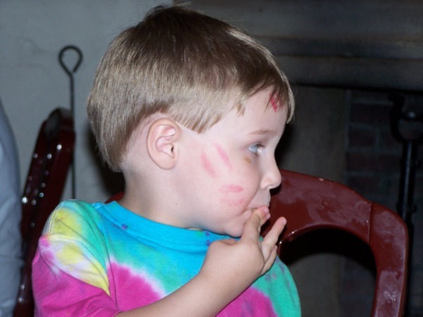 kiss