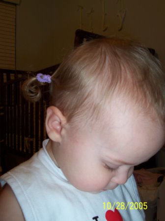 lilydown
