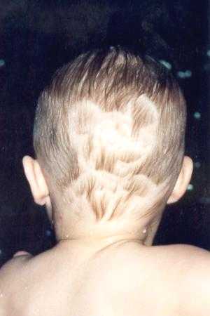 Mickey carved into Evan's hair.