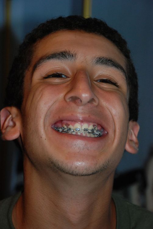 orthodonture