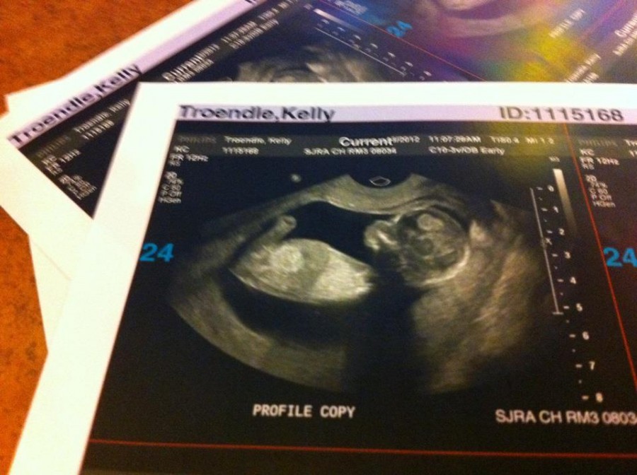 ultrasound