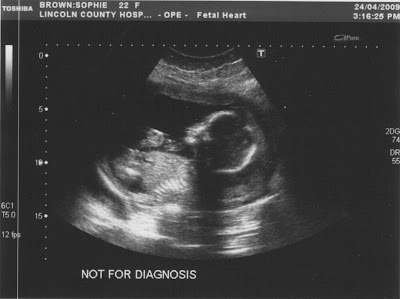 20+Week+3.jpg