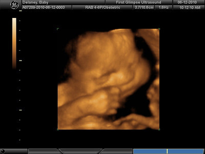 BABY%202_11-S.jpg
