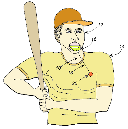 batter_biter.GIF