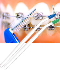 InterbraceInUse.jpg