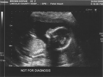 20+Week+1.jpg