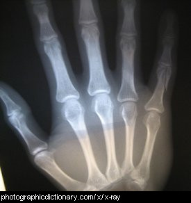 x-ray.jpg