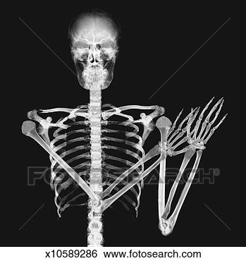 x-ray-image-person_~x10589286.jpg