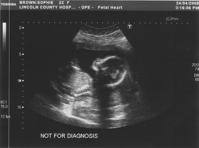 20+Week+2.jpg