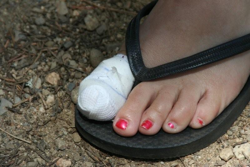 bandaged%2Btoe